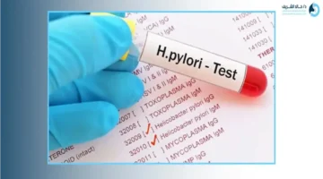 أسعار وأساليب تحليل جرثومة المعدة كيف تختار الفحص المناسب وتحضر له؟ 1